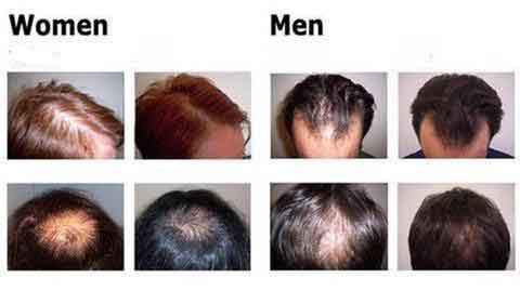 جوهر نمو الشعر العضوي